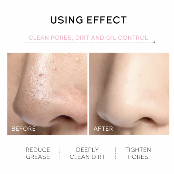 Crema Peel-off de Nariz