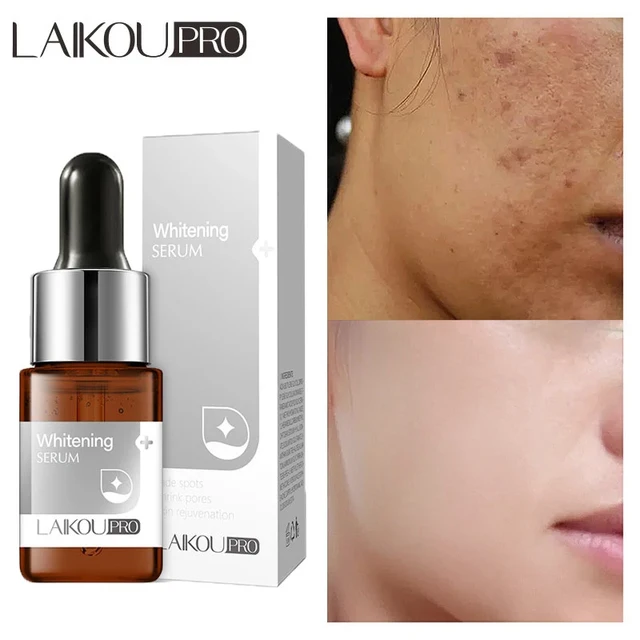 Sérum Whitening